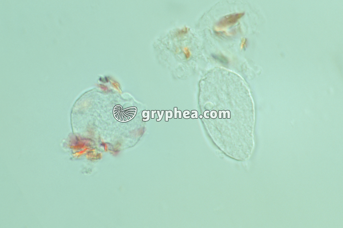 Cellules de pulpe de tomate x100 - gryphea.org